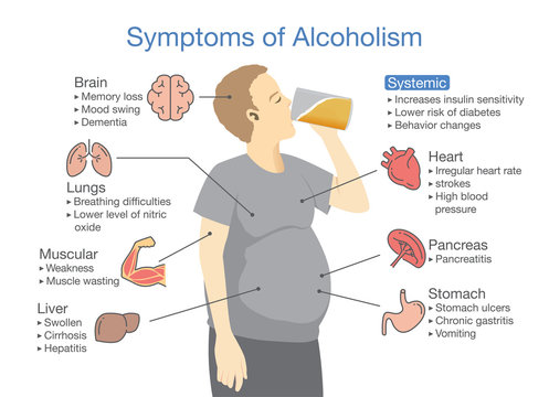 Symptom of alcoholism patient. Illustration about health problem of people with alcohol addiction.