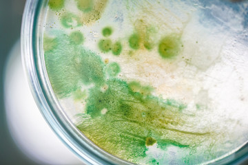 Colony of blue green algae in culture medium plate.