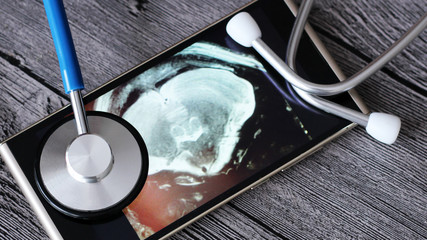 X-ray and stethoscope, medical examination