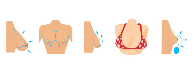 Breast icon set, cartoon style