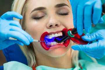 Dentists hands working on young woman patient with dental tools. Female patient with retractor at...
