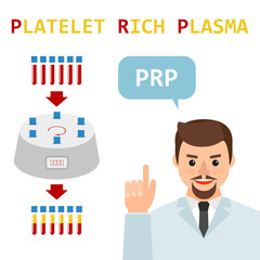 Platelet rich plasma. PRP method. Vector.