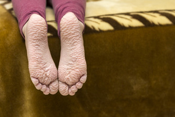 Close-up of children wrinkled feet after long bath