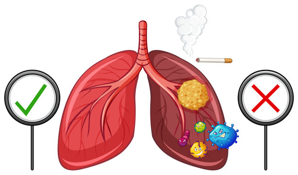 Diagram showing healthy and unhealthy lungs