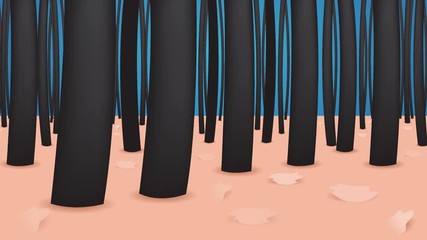 dandruff and no dandruff skin graphic