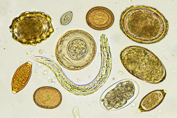 Mixed of helminthes in stool, analyze by microscope
