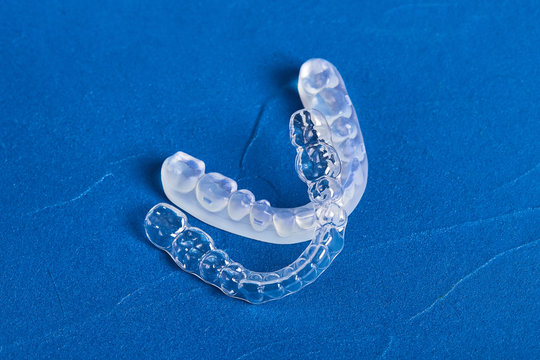 Pre-orthodontic dental trainer alignment appliance