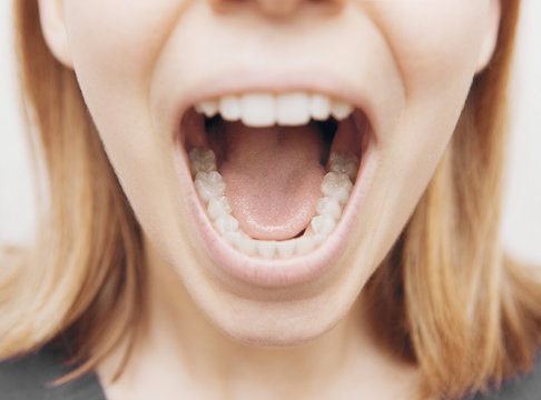 Denti, bocca di donna aperta con denti bianchi