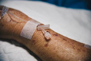 Patient in the hospital with saline intravenous
