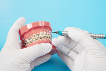 orthodontic model and dentist tool - demonstration teeth model of varities of orthodontic bracket...