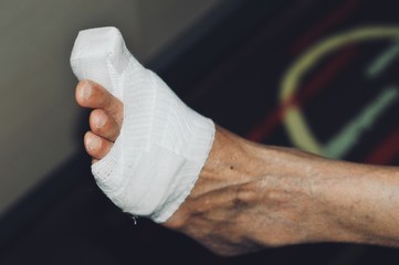 Fototapeta na wymiar Close-up Of A Orthopedist Fixing Plaster On Injured woman’s Foot in hospital, Splint for treating foot injuries. Health care and medical treatment concept