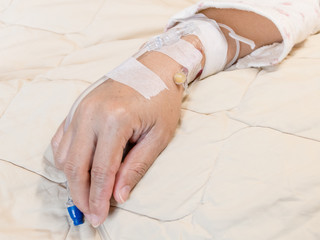Saline intravenous (IV) drip on woman's hand in hospital