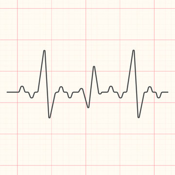 Black cardiogram line illustration on red grid medical background