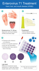 Potency Steroid Cream, Immune Globulin Injection, Gram stain testing. Illustration.