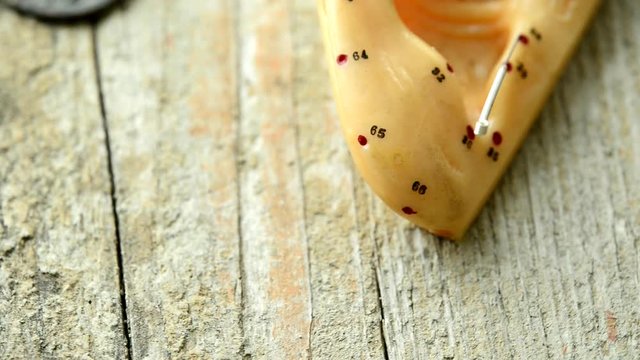 Acupuncture needles and ear acupuncture model on a turn table

