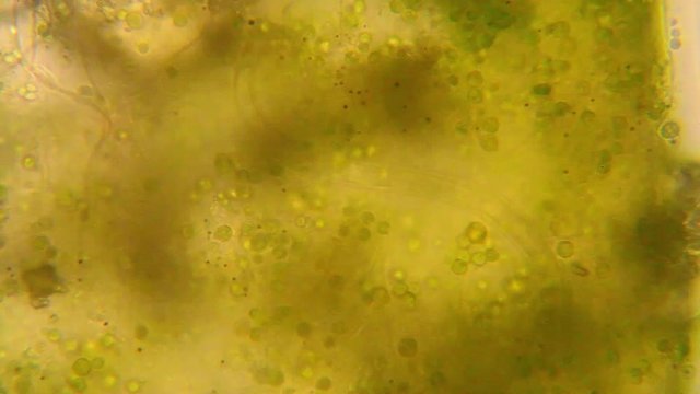 Microscopic view of organisms in the fusty water with rotten vegetation
