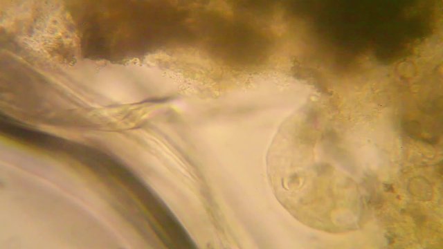 Microscopic view of organisms in the fusty water. Rotifers