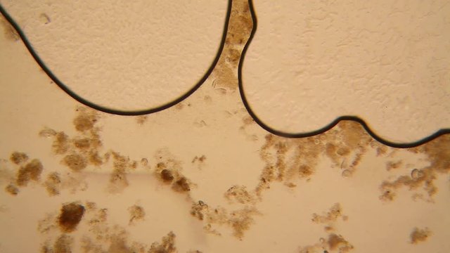 Microscopic view of organisms in the fusty water with rotten vegetation. Paramecium caudatum
