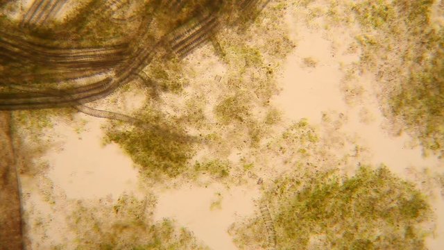 Microscopic view of organisms in the fusty water with rotten vegetation. Paramecium caudatum
