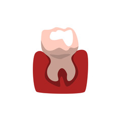 Tooth and gum vector Illustration on a white background