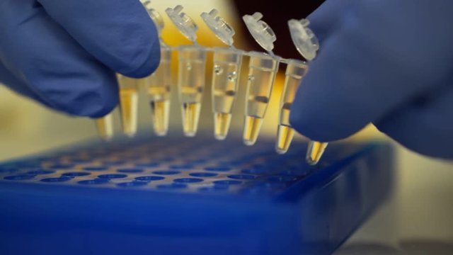 Laboratory test tubes. medical researcher shows DNA samples in well microplate