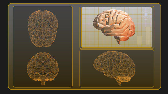 3D brain analysis interface screen on gray BG