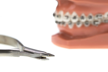 Orthodontic braces and pliers on a white background