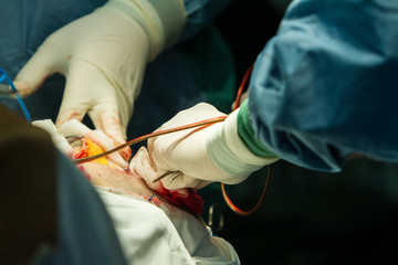 Operation of trepanation of the skull.