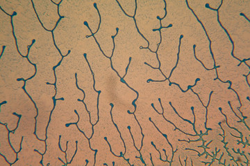 Human cells and dried colorful water at the microscope
