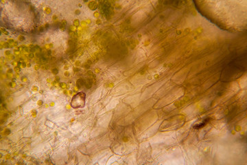 Rotten leaves at the microscope

