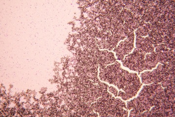 Yeast at the microscope
