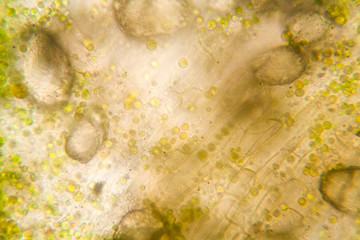 Rotten leaves at the microscope
