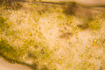 Rotten leaves at the microscope
