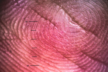 enlarged look of fingerprints. with a millimeter scale.