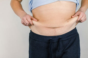 Excess skin on his stomach.