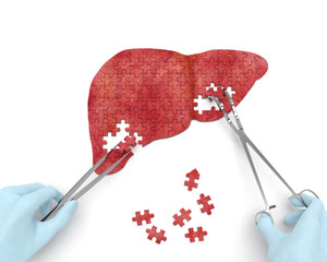 Liver operation puzzle concept: hands of surgeon with surgical instruments (tools) performs liver surgery as a result of hepatic disorder (cirrhosis, hepatic cancer, hepatitis) - obrazy, fototapety, plakaty