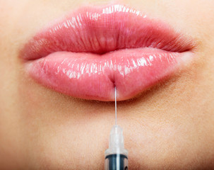 Obraz premium Closeup shot of beautiful female lips and syringe with filler