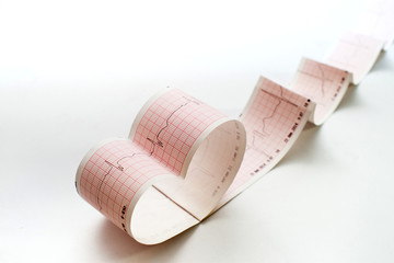 Stethoscope on the electrocardiogram graph