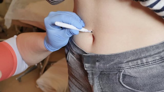 The first piercing. Female piercing. Marking for a hole for earrings.