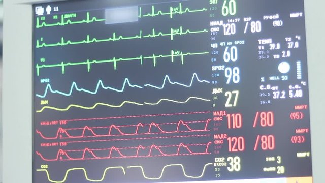 Simulated Heart Monitor Screen