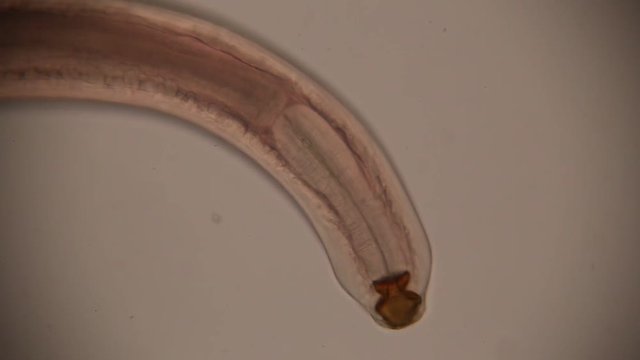  Camallanus is a genus of parasitic roundworms in the family Camallanidae  for education in laboratory.