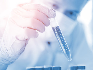 closeup hand of scientist in lab . Hand hold syringe  blood in tube , Testing result  Medical or chemical background