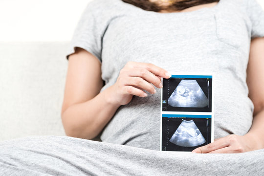 Happy pregnant woman sitting on sofa at home and holding ultrasound scan photos on her belly.