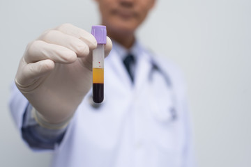 Male doctor showing  centrifuge blood test tube
