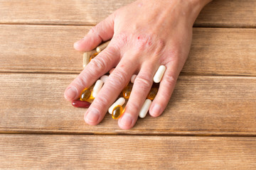 Hands of the girl with atopic dermatitis with tablets . On the background of wooden table