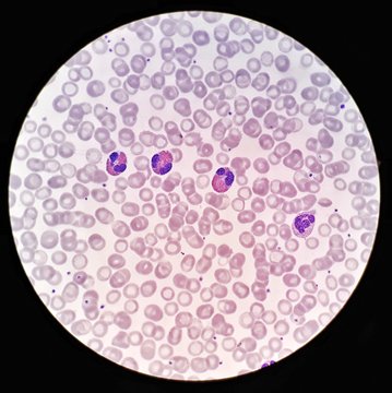 Eosinophil under microscope