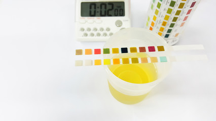 A urine  strip test used to determine in urine sample . The test read result in 60 to 120 seconds...