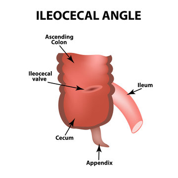Ileocecal angle. Ileocecal valve. Bauginiev s damper. The ileum, the Cecum, the Apendix. Colon. Infographics. Vector illustration on isolated background.