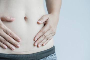 Closeup of woman showing on her belly dark scar from a cesarean section.