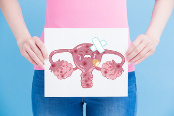 woman take uterus billboard
